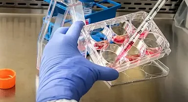 Fransa'da Ebola vakası: Kongo'dan dönen doktorda virüs tespit edildi